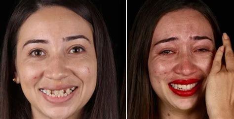 Dentist gives free dental makeovers and shares the incredible before and after photos of their ...