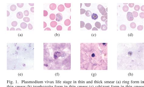 Figure 1 from Image analysis for malaria parasite detection from ...