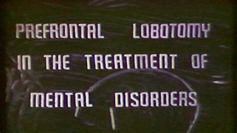 Prefrontal Lobotomy