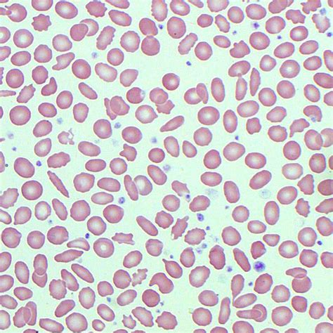 Platelets In Blood