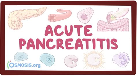 Acute pancreatitis: Video, Anatomy & Definition | Osmosis