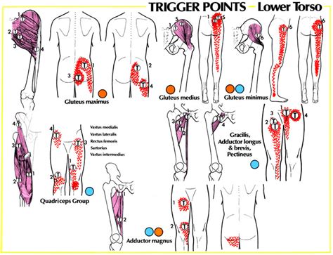 MAKLUMAT KESIHATAN DAN PENYAKIT: Trigger Point Referral Patterns