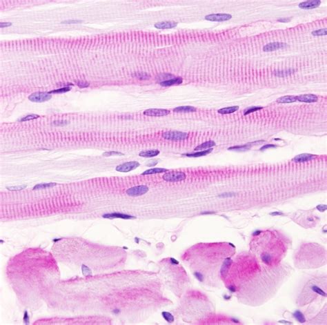 Histologia musculo estriado - Imagui