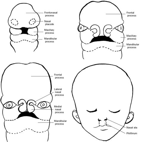 Maxillary Process Embryology