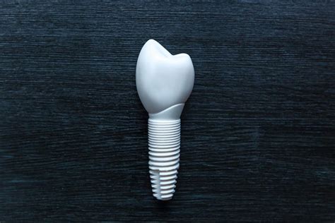 Metal-free Dental Implants - Ceramic and Zirconia: Sydney Dental ...