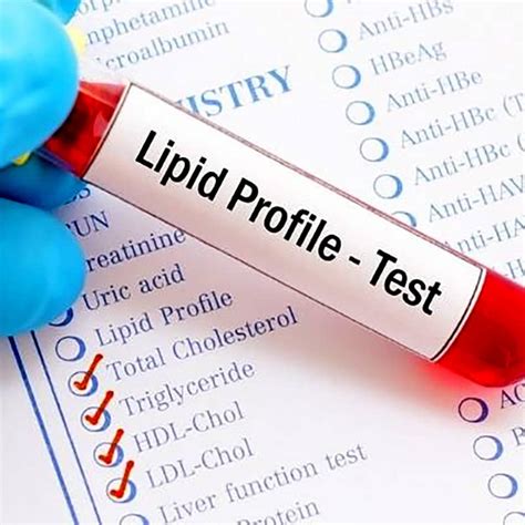 Lipid Profile Test - Biocity Healthcare