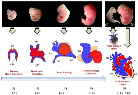 Schematic presentation of embryonic cardiac developmental stages ...