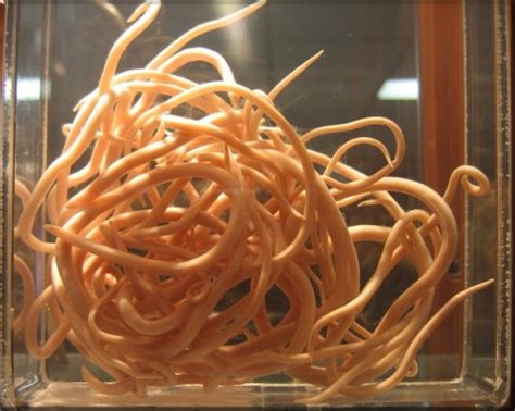 Roundworms. Causes, symptoms, treatment Roundworms