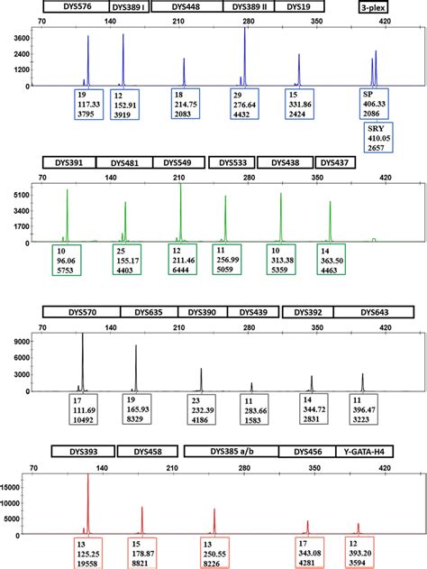 An electropherogram generated from DNA obtained from a semen sample... | Download Scientific Diagram