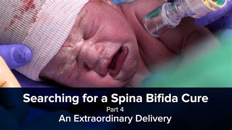 Searching for a Spina Bifida Cure Part 4 - An Extraordinary Delivery ...