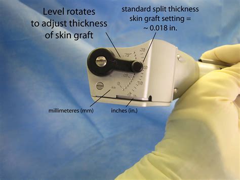 Case Example - Split Thickness Skin Graft (STSG) Zimmer Dermatome settings | Iowa Head and Neck ...