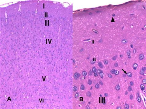 Showing six layers of cerebral cortex of control group; molecular layer... | Download Scientific ...