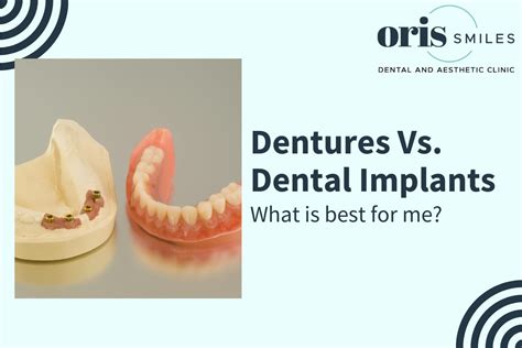 Dentures Vs. Dental Implants: What is best for me? - Oris Smiles