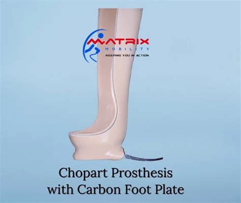 Chopart Prosthesis Carbon Foot Plate at Rs 25000 | Prosthetics Foot in Mumbai | ID: 27136180812