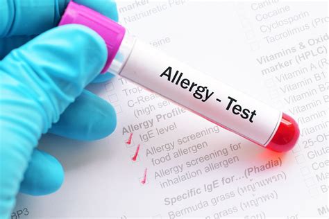 Allergy Testing Singapore | Skin Prick | Reliable IgE RAST 2022