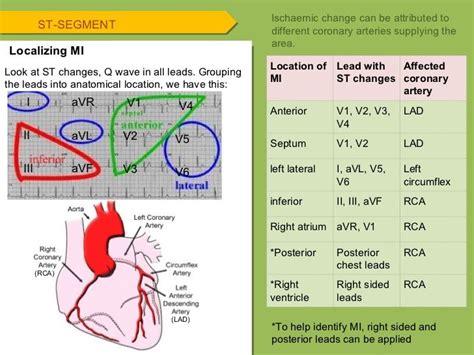 Pin by Rach N on Medicine | Arteries anatomy, Arteries, Ekg leads