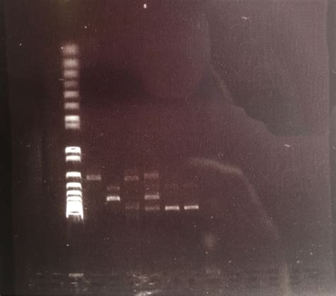 Solved My result:DNA ladder that you compare | Chegg.com