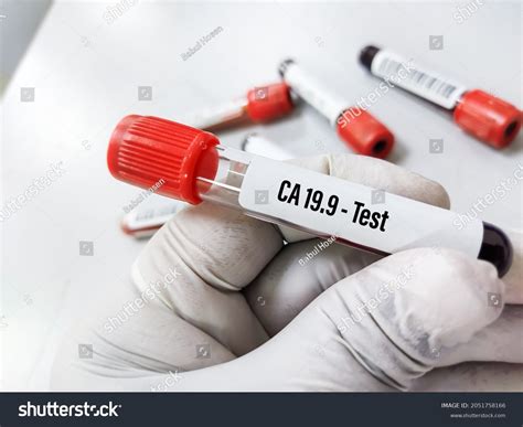 48 Pancreatic Cancer Blood Analysis Images, Stock Photos & Vectors | Shutterstock