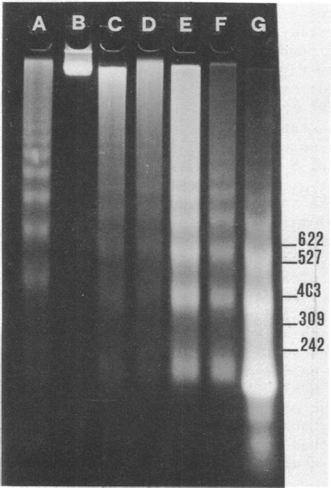 Ethidium bromide staining pattern of nucleosomal DNA. Nucleosomal DNA ...