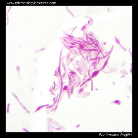 Bacteroides fragilis. Gram stain and cell morphology. Bacteroides ...