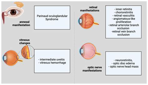 Parinaud Oculoglandular Syndrome