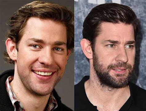 John Krasinski Plastic Surgery: Nose job and Facelift