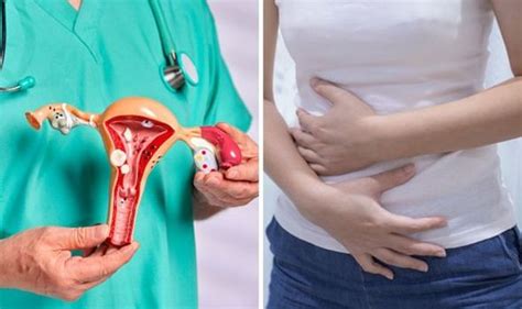 Do YOU have a tilted uterus? The 7 symptoms of a retroverted uterus ...