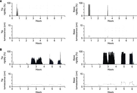 (A) Nocturnal penile tumescence test (NPT) checked at 3 weeks showed 2... | Download Scientific ...