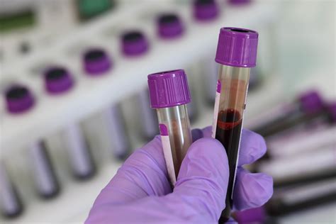 Blood Tests Explained | Lab Testing API