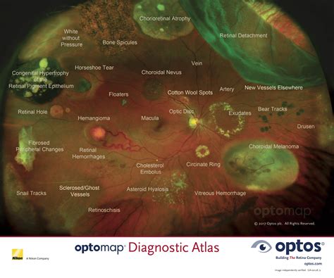 optomap-digital-retinal-imaging-a-new-standard-of-eye-care – Premier ...