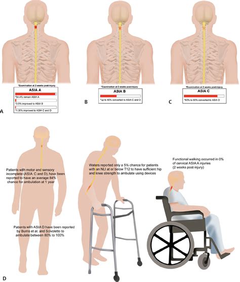 Spontaneous Recovery Patterns and Prognoses after Spinal Cord Injury | Musculoskeletal Key