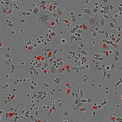 Phagocytosis Microscope