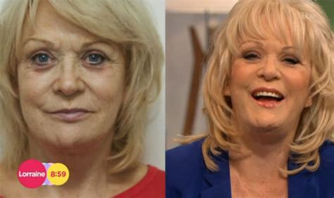 Sherrie Hewson in tears over plastic surgey makeover on Lorraine | TV & Radio | Showbiz & TV ...