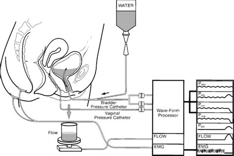 Urodynamic Testing Procedure