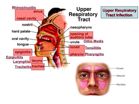 Upper Respiratory Tract System