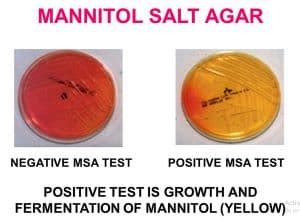 Mannitol Salt Agar - Plate, Test, Composition, Preparation, Uses - Laboratoryinfo.com