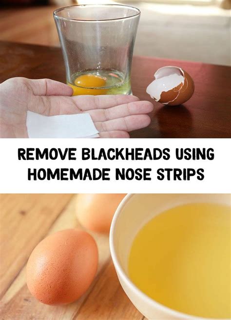 Homemade strip - Remove blackheads using homemade nose strips | Nose strips, Blackheads, Diy ...