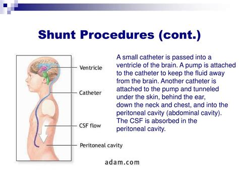 PPT - Care of the Client with Cranial Surgery PowerPoint Presentation, free download - ID:292611