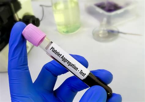 Premium Photo | Platelet aggregation test, diagnosis for platelet disorders. flow cytometry.