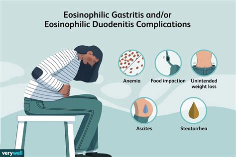 Eosinophilic Gastritis and/or Eosinophilic Duodenitis: Causes, Symptoms ...