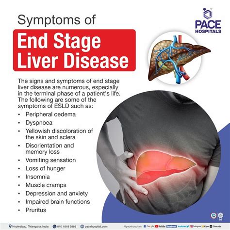 End Stage Liver Disease: Symptoms, Causes, Complications