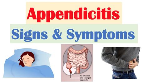 Appendicitis Signs & Symptoms | & Why They Occur - YouTube