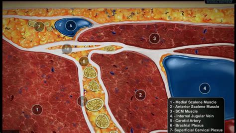 Ultrasound-Guided Interscalene Brachial Plexus Block Video - NYSORA The New York School of ...