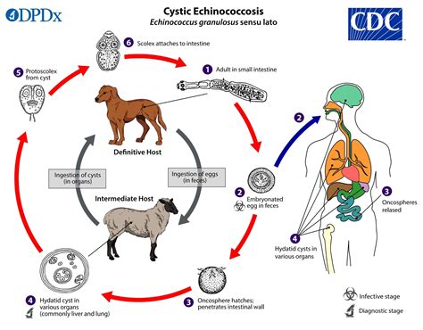 Echinococcus: Symptoms, Causes and Treatment | Healthtian