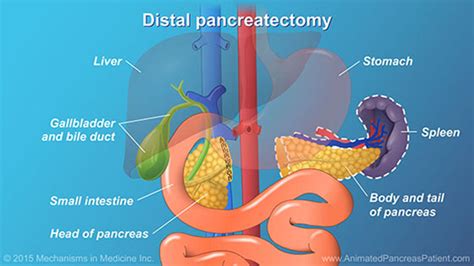 Understanding Pancreatic Surgery: Benefits, Risks, and Relevant Anatomy