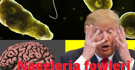 USA Recent Pandamic||Naegleria fowleri brain-eating amoeba|Symptoms|2020 - Dictionary of Mahadi