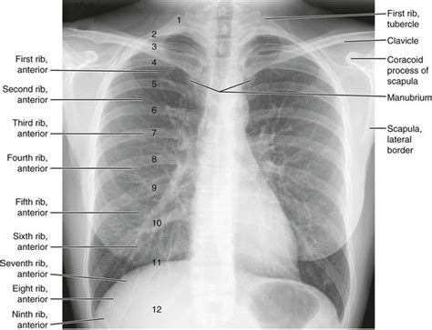 Normal Anatomy | Radiology Key