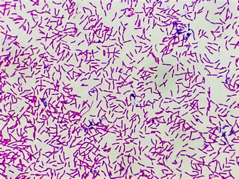 Mikroskopische Ansicht der Gram-Färbung mit stäbchenförmigen Escherichia coli- oder E. coli ...