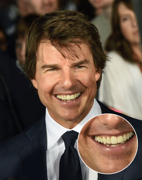 Tom Cruise Smile: The Iconic Smile Of Hollywood's A-List Star