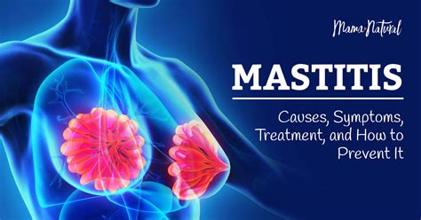 Mastitis: Causes, Symptoms, Treatment, and How to Prevent It